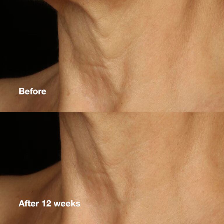 Clinique Smart Clinical Repair Lifting Face + Neck Cream