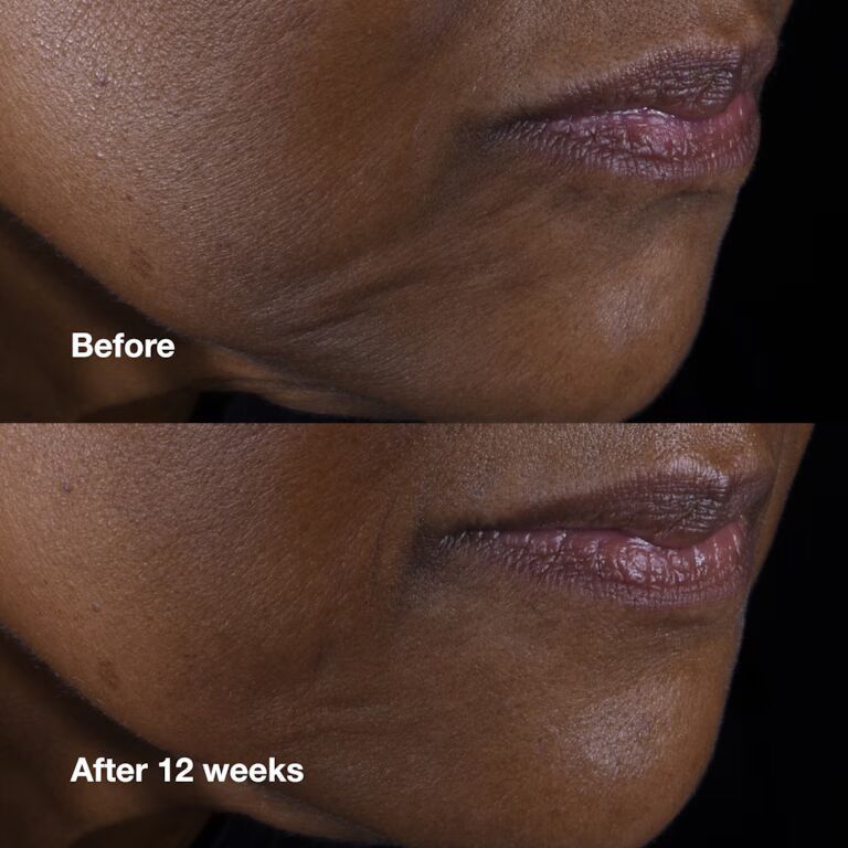 Clinique Smart Clinical Repair Lifting Face + Neck Cream