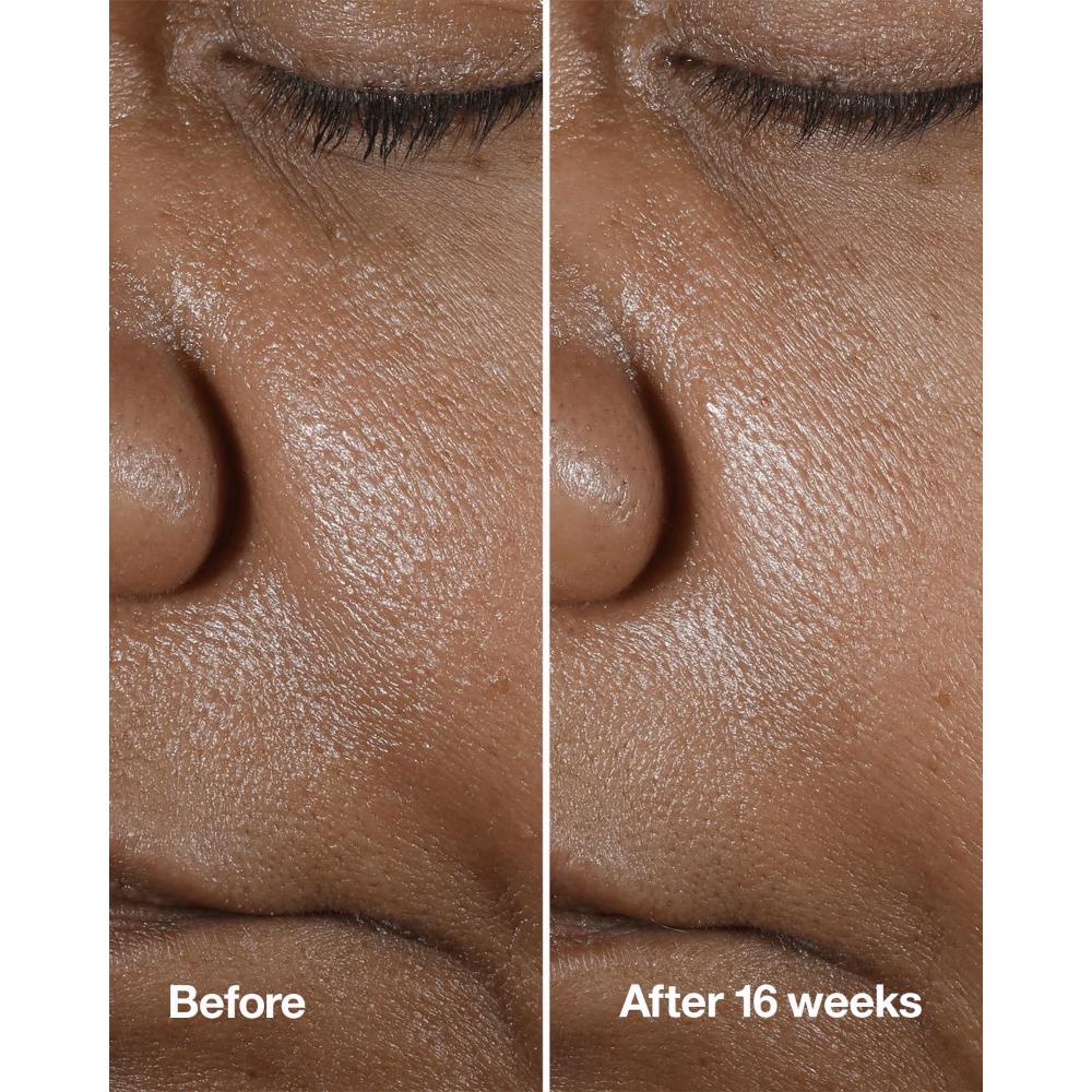 Clinique Smart Clinical Repair Wrinkle Correcting Serum With Retinoid