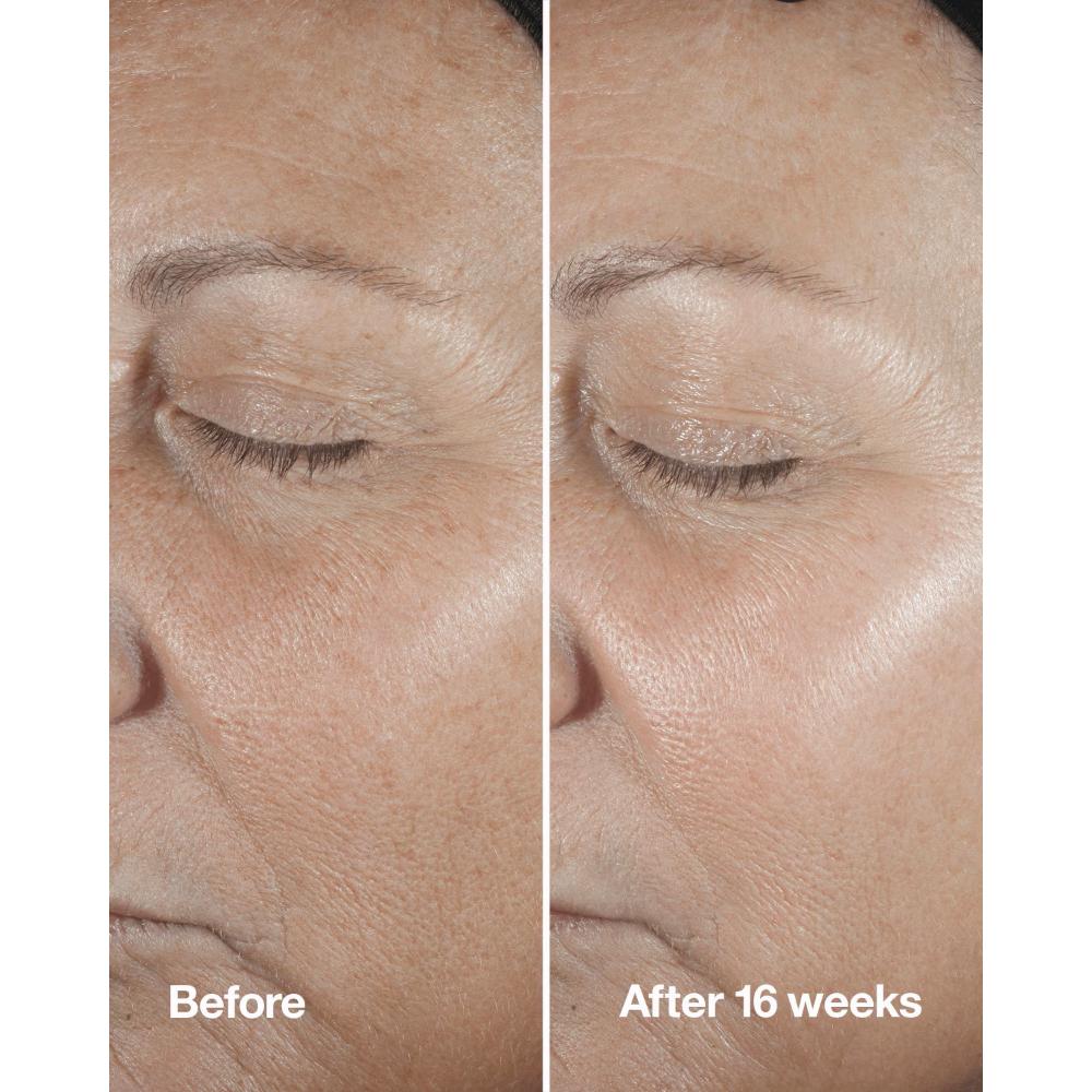 Clinique Smart Clinical Repair Wrinkle Correcting Serum With Retinoid
