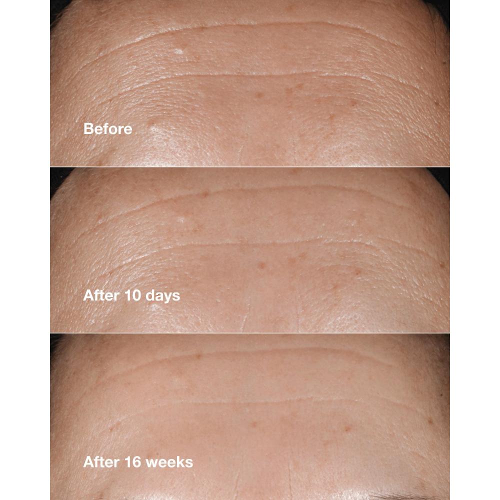 Clinique Smart Clinical Repair Wrinkle Correcting Serum With Retinoid